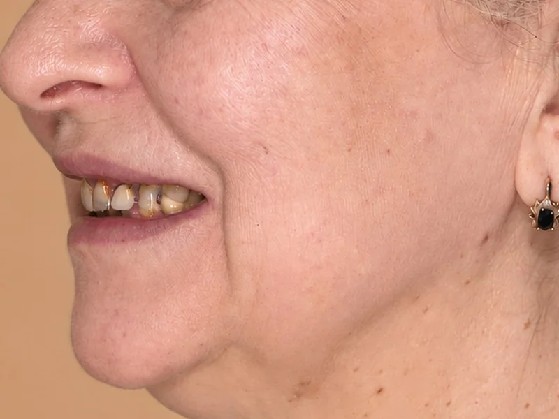 Before treatment