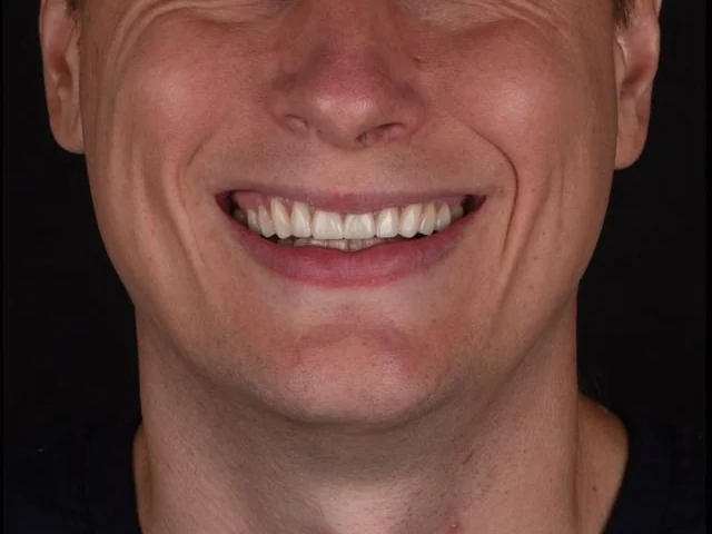 After treatment