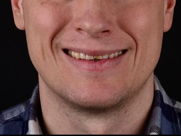 Before treatment