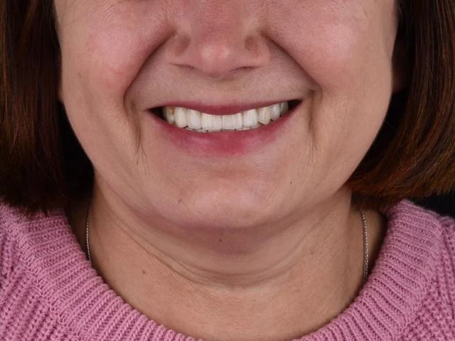 After treatment