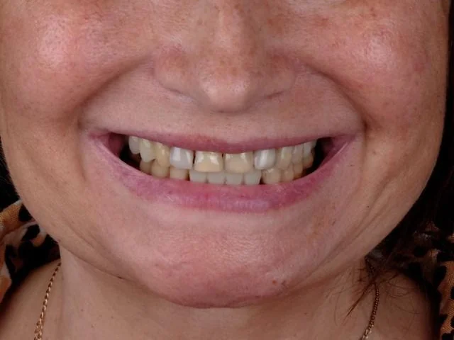 Before treatment