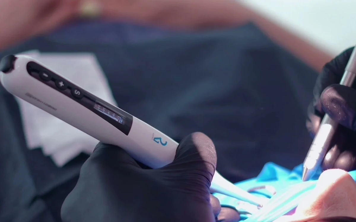 An intraoral scanner taking a digital impression